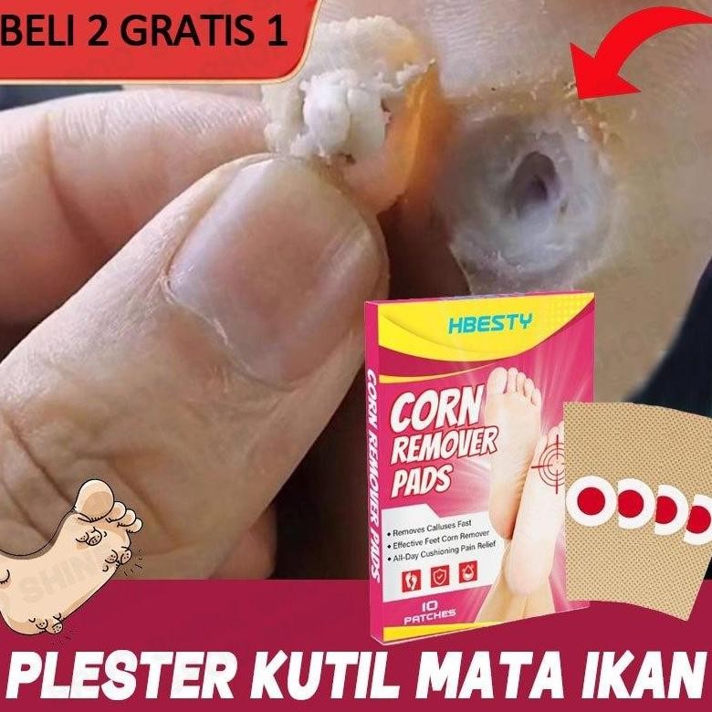 Plester Kutil Mata Ikan Foot Corn Removal Plester Corn Removal Plester Penghilang Kutil  Callusol Ma