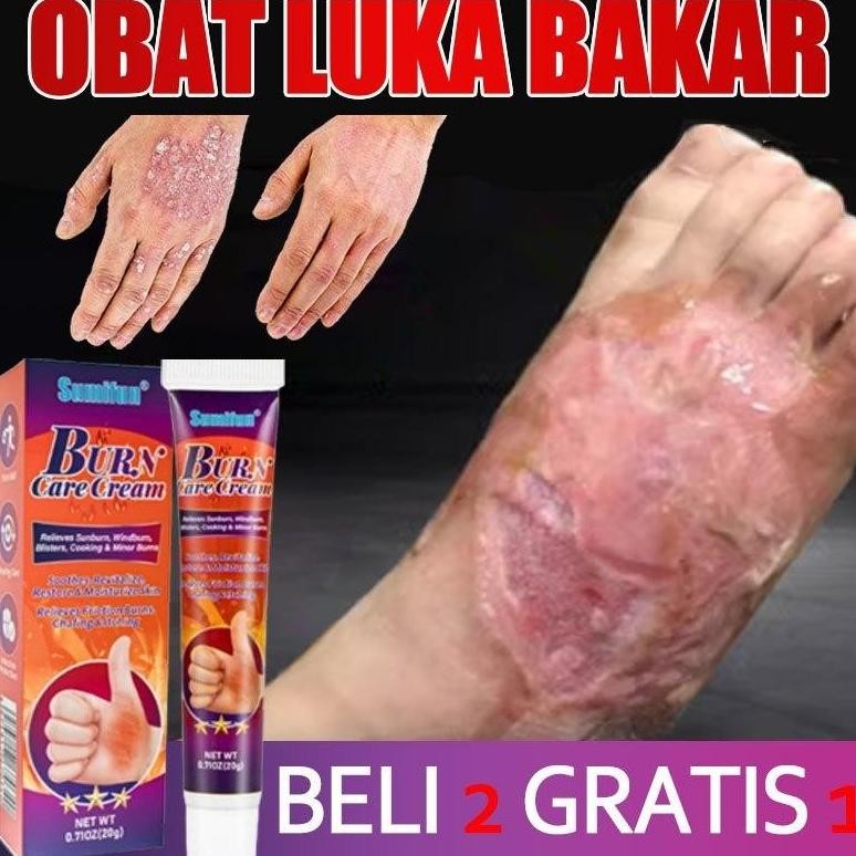 Salep Luka Bakar Paling Ampuh Obat Luka Bakar Salep Bekas Luka Bakar Penghilang Bekas Luka Bakar Men