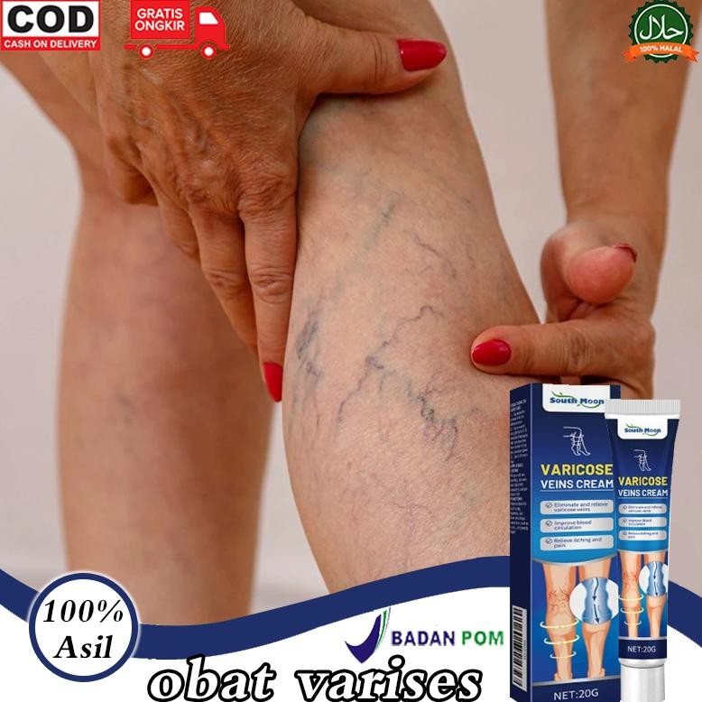 BpomVarises Original Obat Parises Kaki Paling Ampuh Salep Varises 20G Salep Laba-Laba Pengobatan Vas
