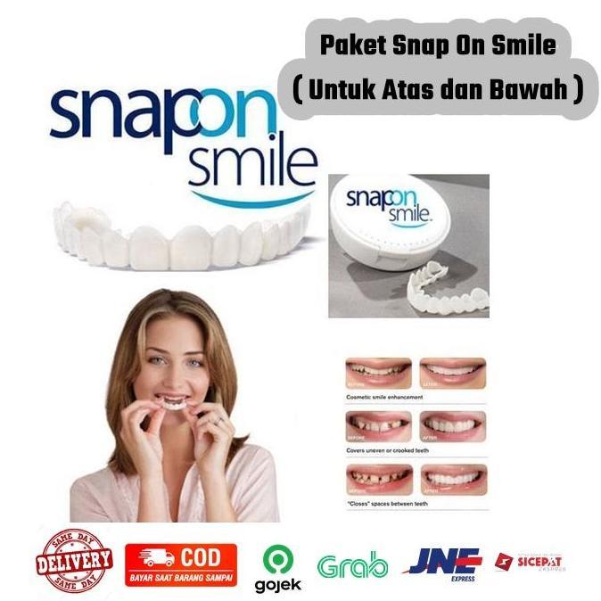 revanggajati82 - snap on smile veneers gigi perfect smile gigi tiruan gigi palsu