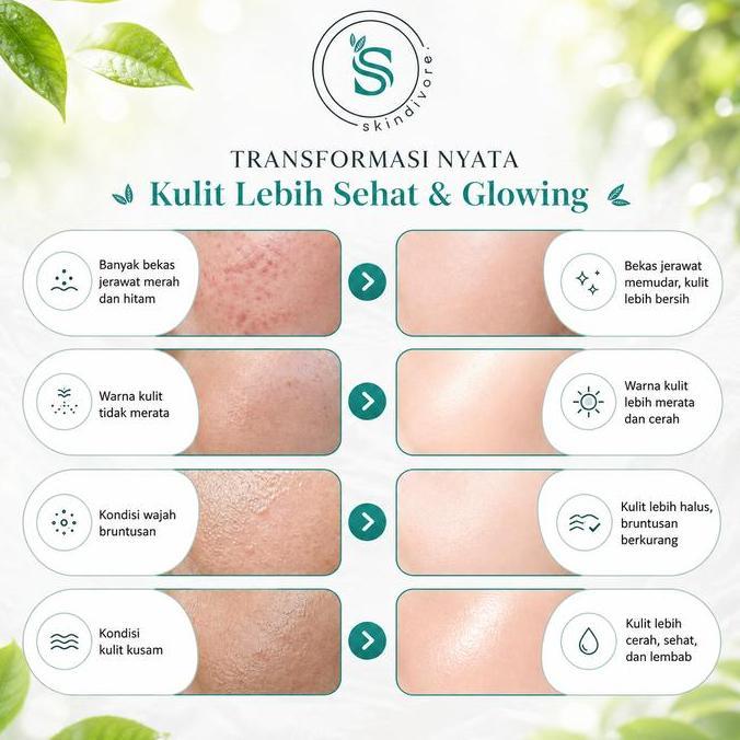 Bellis- [Bundling] Masker Organik Skindivore Fullsize 60Gr | Bpom