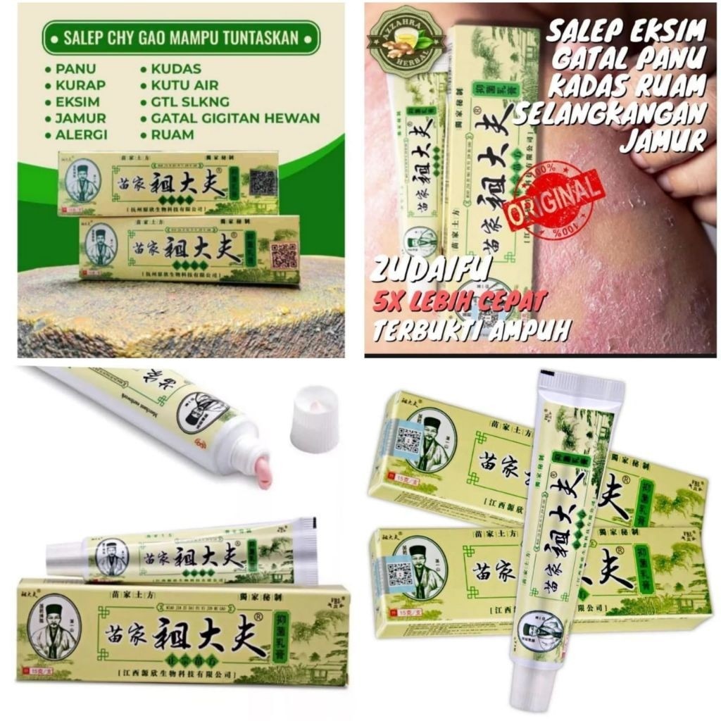 Salep Gatal Cina Ampuh Mengatasi Gatal Jamur Eksim Psoriasis Herbal