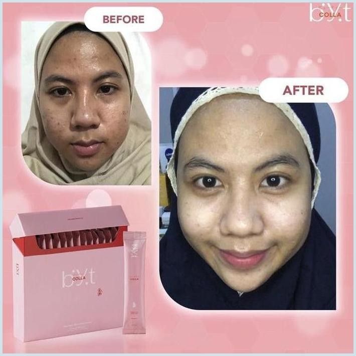 NEW BYT COLLA 8 BOX - KOLAGEN / COLLAGEN TRIPEPTIDE TERLARIS