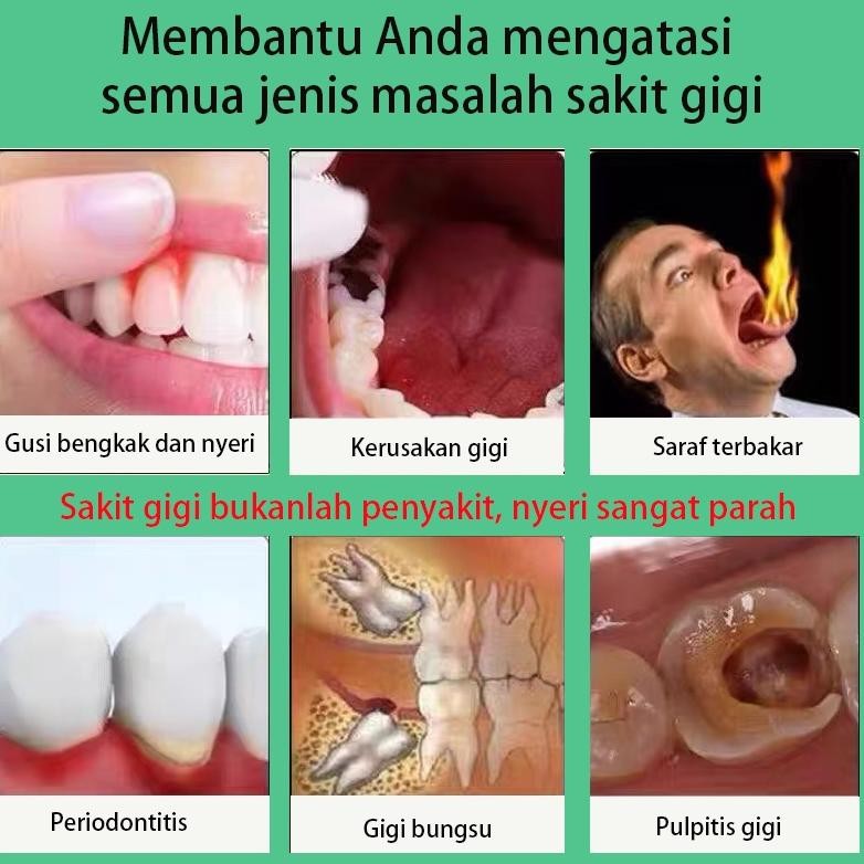 Semprotan Pereda Nyeri Sakit Gigi Bengkak Obat Sakit Gigi Berlubang Ampuh Obat Sakit Gigi Semprot Pe
