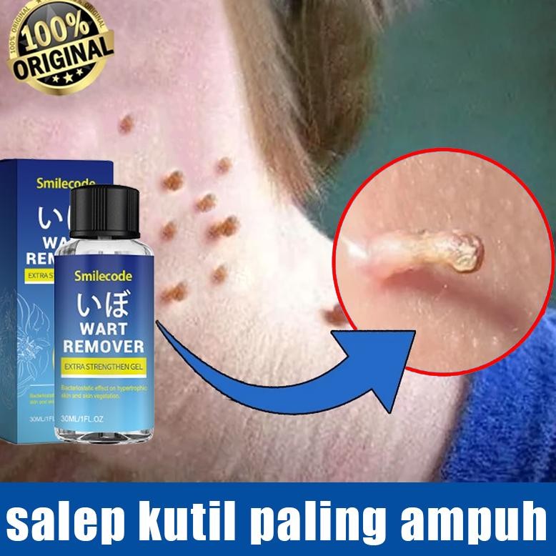 Bpom Wart Remover Original 30Ml Obat Kutil Paling Ampuh Oles Salep Penghilang Tahi Lalat Salep Kutil