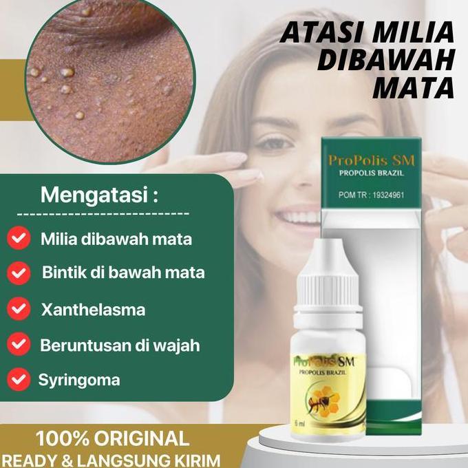 JAR_FASHIOM - PROPOLIS SM PENGHILANG MILIA PADA WAJAH, PERONTOK MILIA KELOPAK MATA, MILIA PADA HIDUN