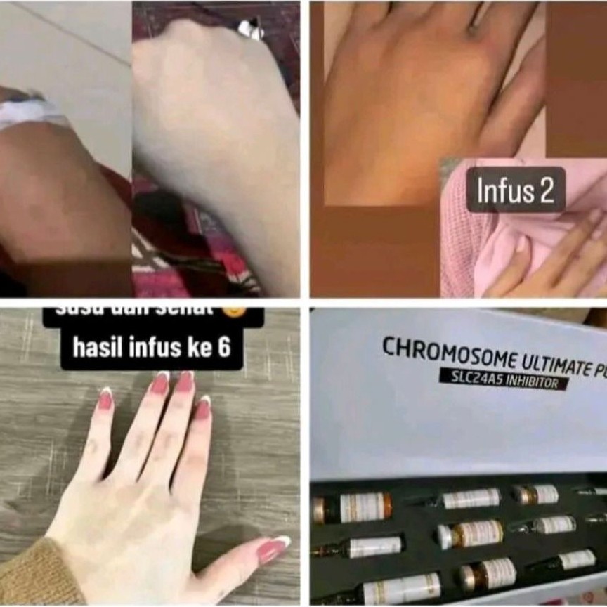 chromosome ultimate plus