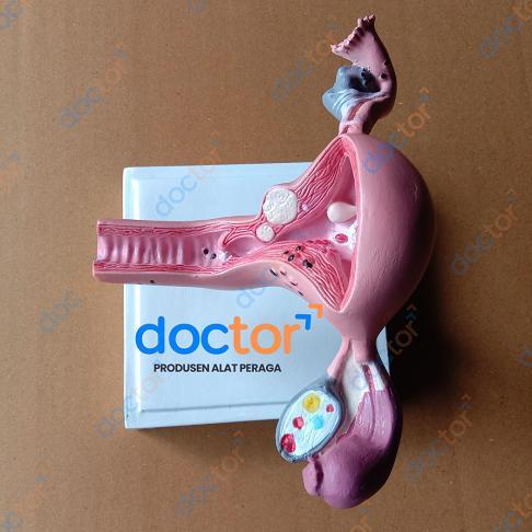 [doctor] Uterus Ovary Anatomical Model Anatomi-Manekin Model Uterus Rahim-Torso Uterus Ovarium Alat 