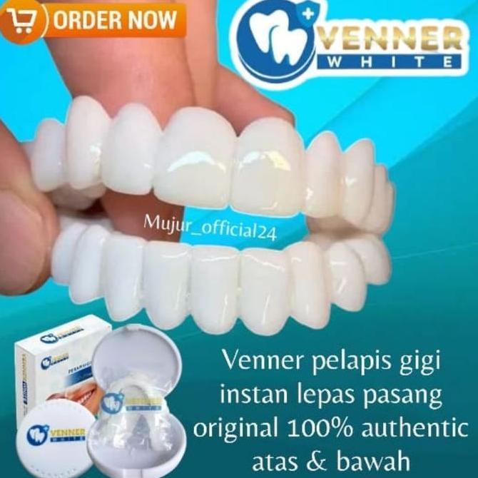 VENNER WHITE gigi palsu instan || perapih gigi 100% ORI Original