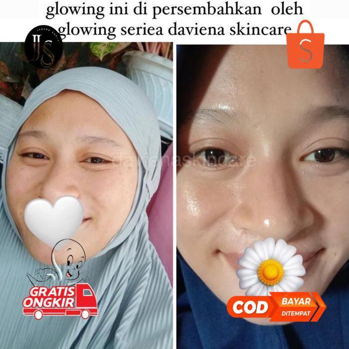 RHH-1823 [Official] Daviena Skincare | GLOWING SERIES | PEMUTIH WAJAH BPOM|DAVINA SKINCARE Termurah