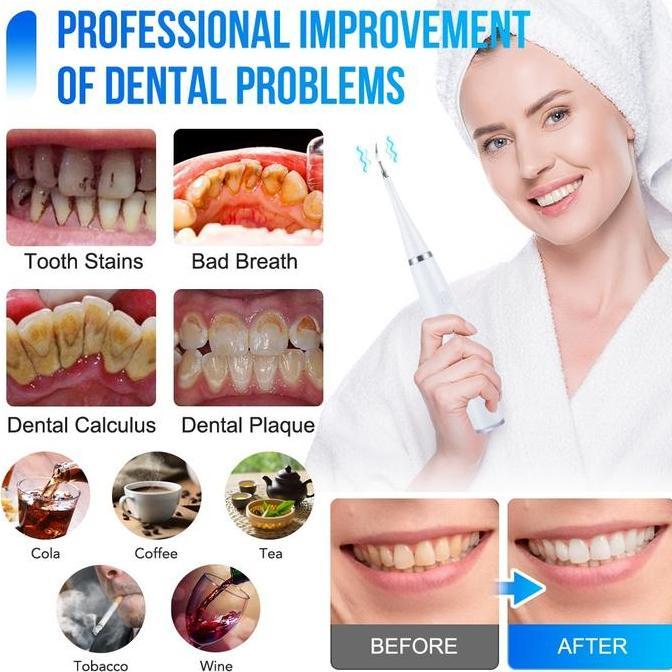 Smart Alat Pembersih Karang Plak Sikat Gigi Electric/ Alat Pembersih Karang Gigi Penghilang Plak Ele