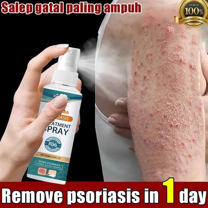 Spray Gatal Selangkangan Eksim Psoriasis Jamur BPOM 1ml