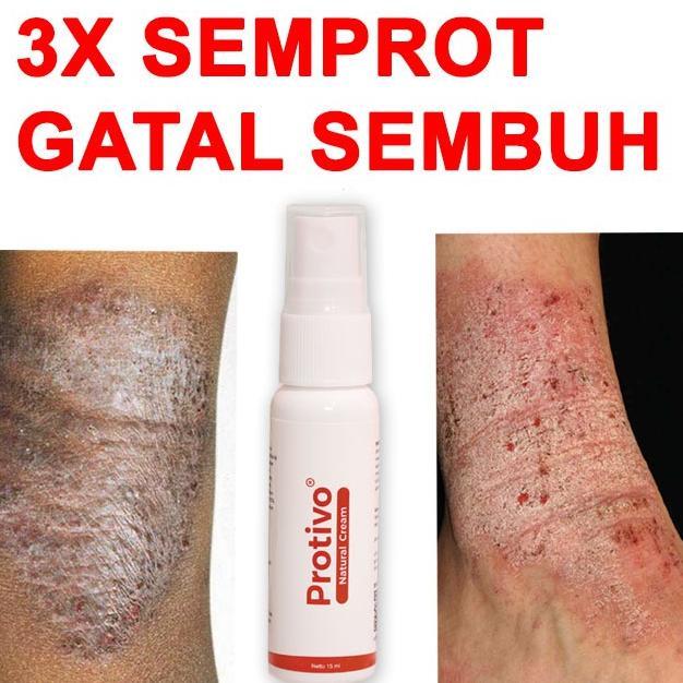 DelOnA- Protivo Natural Cream | Obat Gatal | Salep Gatal | Cream Gatal | Obat Kulit Gatal | Obat Gat