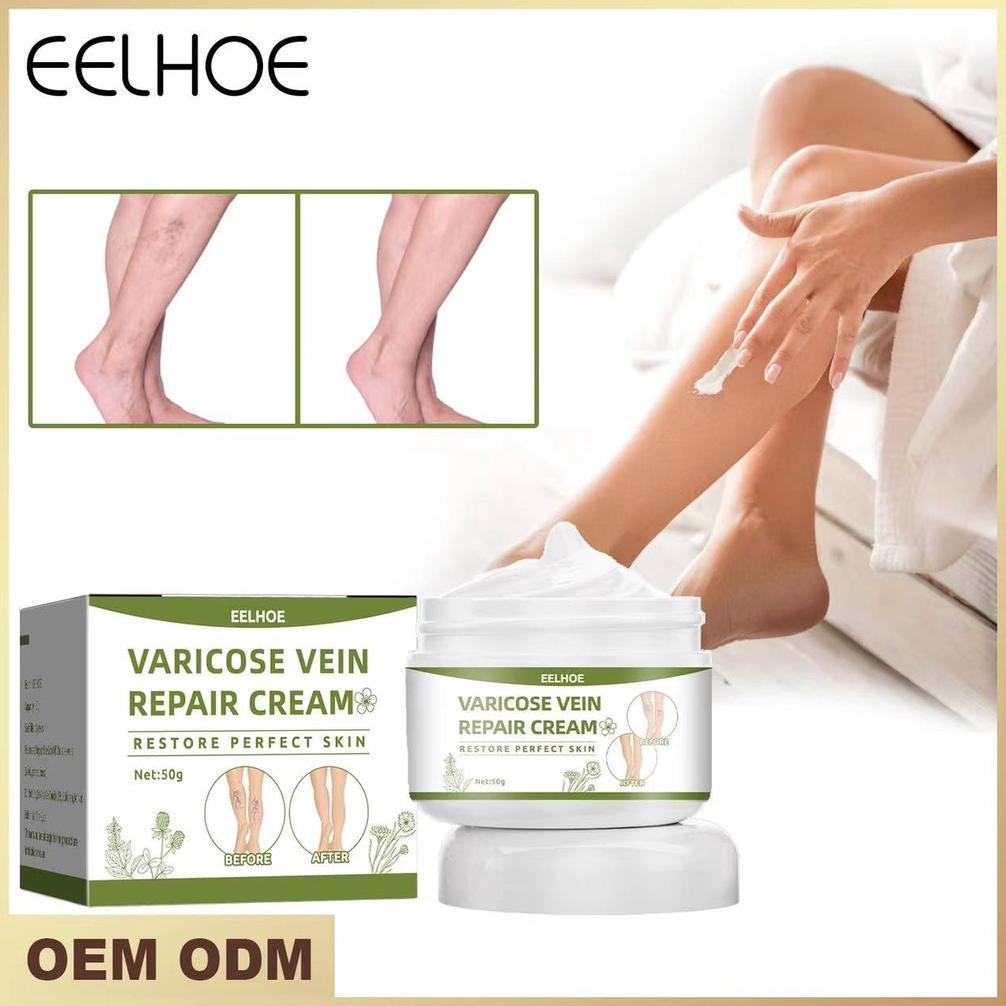 CantikQ- Eelhoe Krim Permanen Varises Krim Varises Vena Salep Flebitis Krim Kaki Varises Vena Pereda