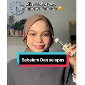 Osso- Minyak Kayu Putih Cap Ayam 150 Ml / Cap Ayam Minyak Kayu Putih 150 Ml