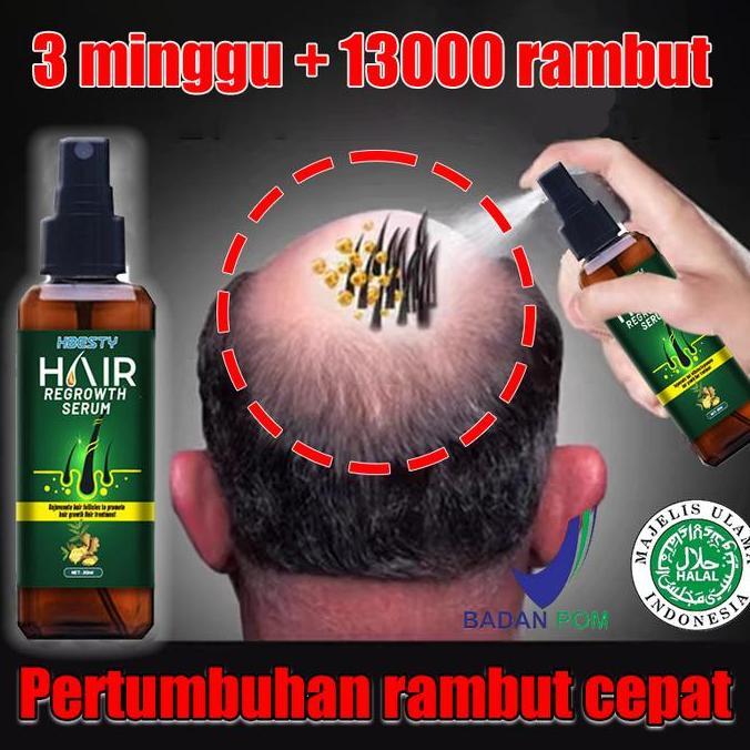 Letssist- Hair Growth Spray Penumbuh Rambut Cairan Serum Penumbuh Rambut Anti Rontok / Obat Rambut B