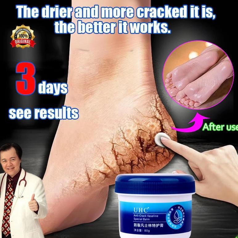 Vaseline cream kaki pecah dan kering Obat kaki pecah pecah 80g obat kaki pecah krim kaki pecah dan k