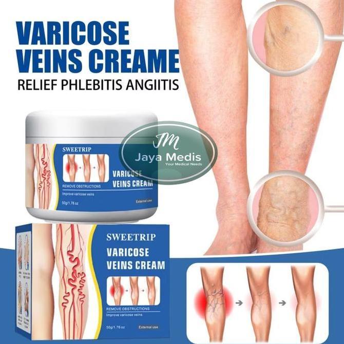 SWEETRIP Cream Varises - Salep Varises