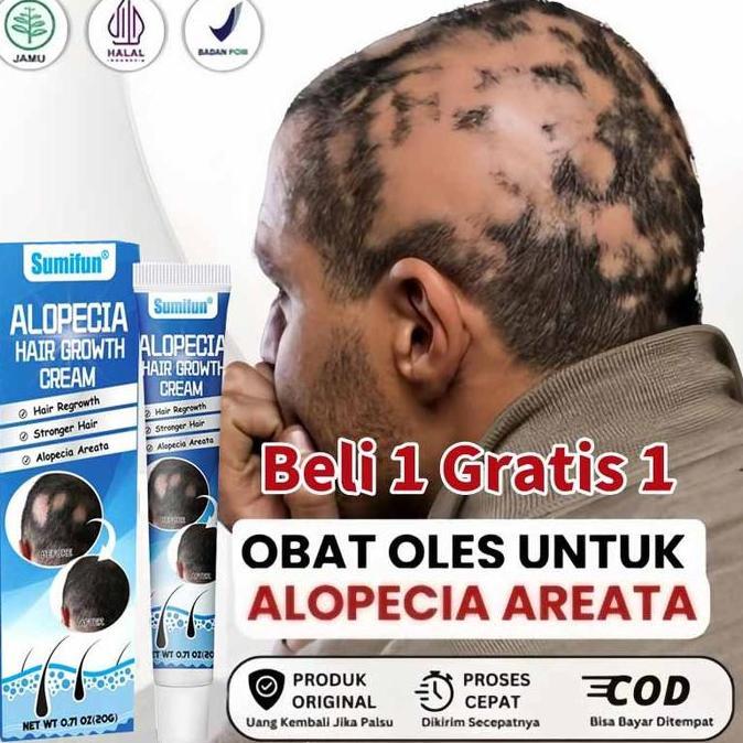 Haircare- Obat Alopecia Areata, Salep Pitak, Obat Botak Koin, Obat Penumbuh Rambut Botak, Kebotakan 