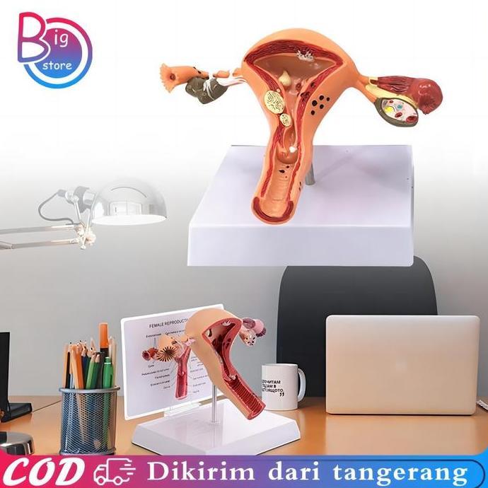 Uterus Ovary Anatomical Model Anatomy Alat Peraga Anatomi Model Patologis Uterus Ovarium Manekin Rah