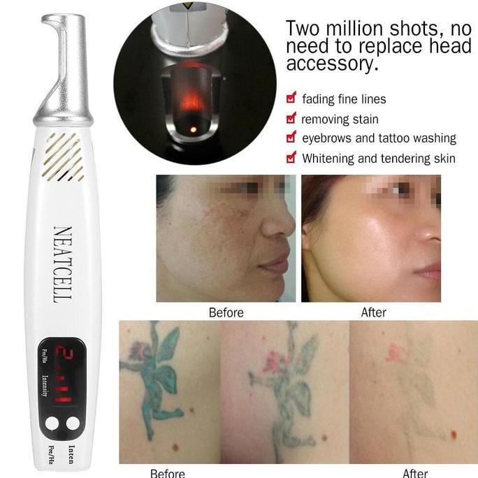 Laser Merah Neatcell Penghilang Tatto