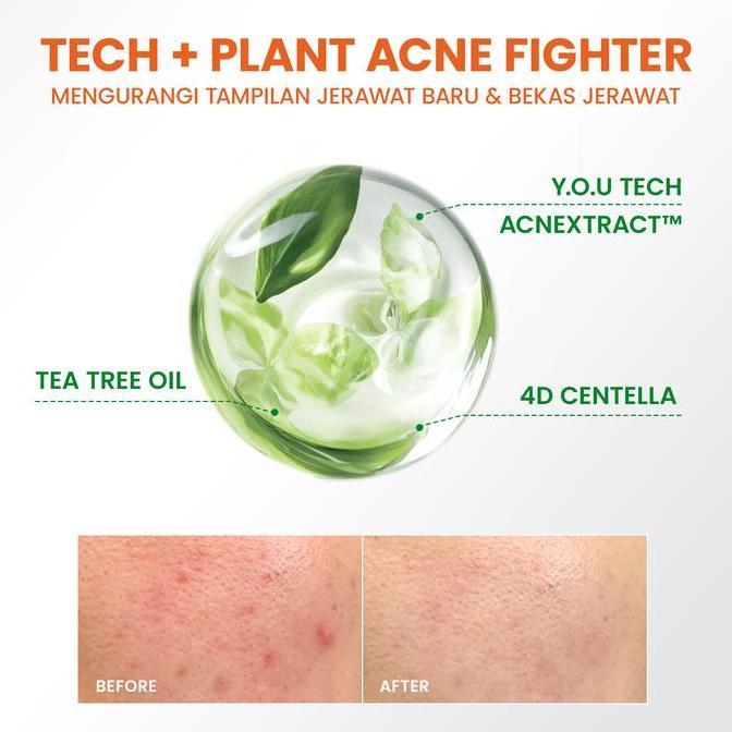Skinwill- You Acneplus 2% Bha Fight Acne Serum | Serum Jerawat | Kulit Berminyak Berjerawat | Salicy