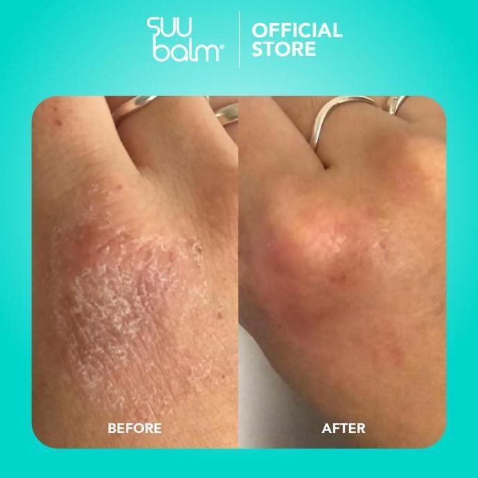 Skinwill- Adult Body Care Pack - Suu Balm Dual Cooling & Moisturising Cream Body Wash (420Ml) & Suu 