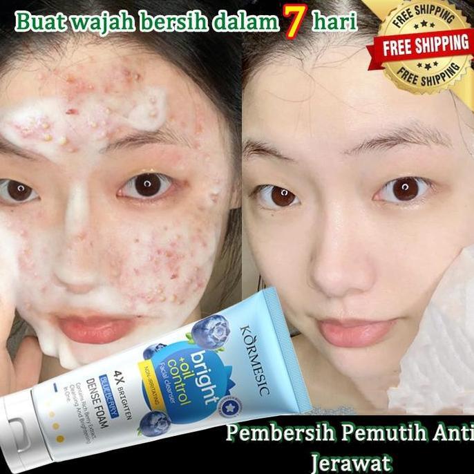 Acne Cleanser Scrub 100G Bpom Acnes Facial Wash Sabun Cuci Muka Jerawat Sabun Muka Glowing Dan Memut
