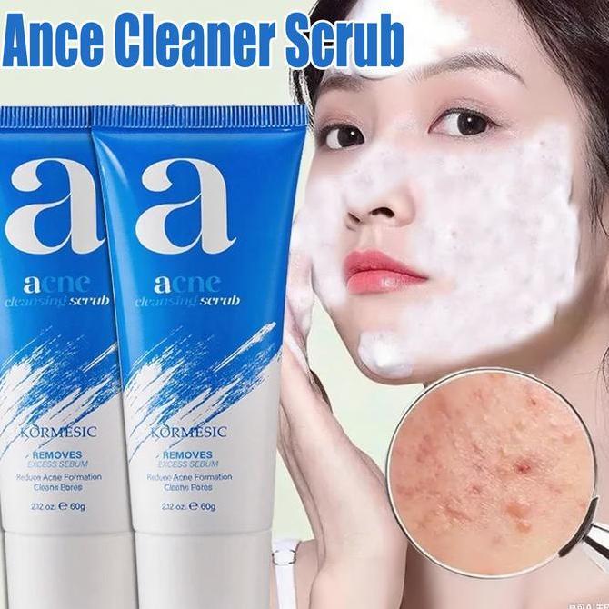Acne Cleanser Scrub Bpom Acnes Facial Wash 60G Sabun Cuci Muka Jerawat Sabun Muka Glowing Dan Memuti