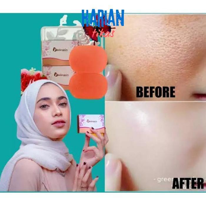 er-23 Of14 Klinskin beauty soap / sabun klinskin original klin skin pemutih wajah BPOM RESMI Terlari