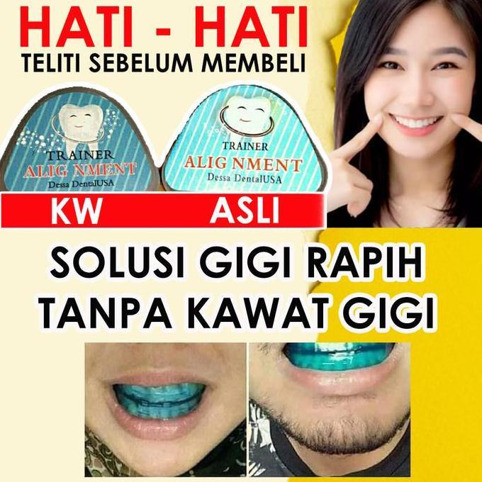 Perapi Gigi Ori Teeth Alignment | Behel Perapi Gigi Asli Kualitas Terbaik Harga Termurah