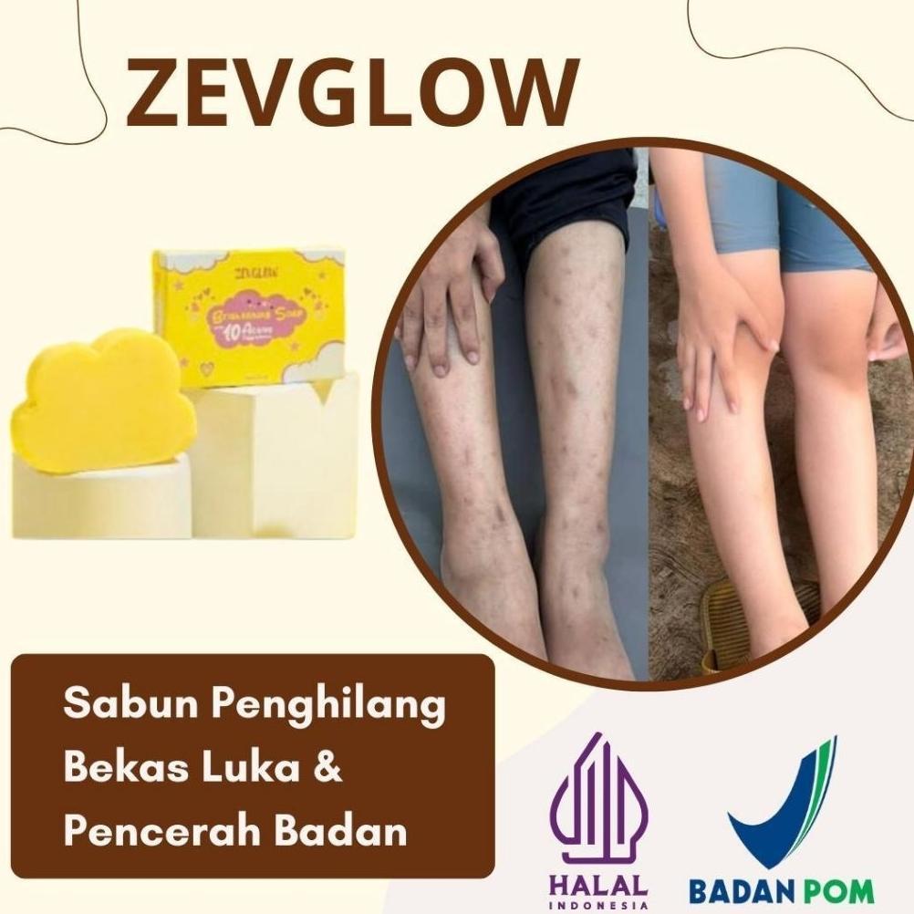 ZEVGLOW WHITENING SOAP (SABUN PEMUTIH BADAN & WAJAH) SABUN PENGHILANG BEKAS LUKA