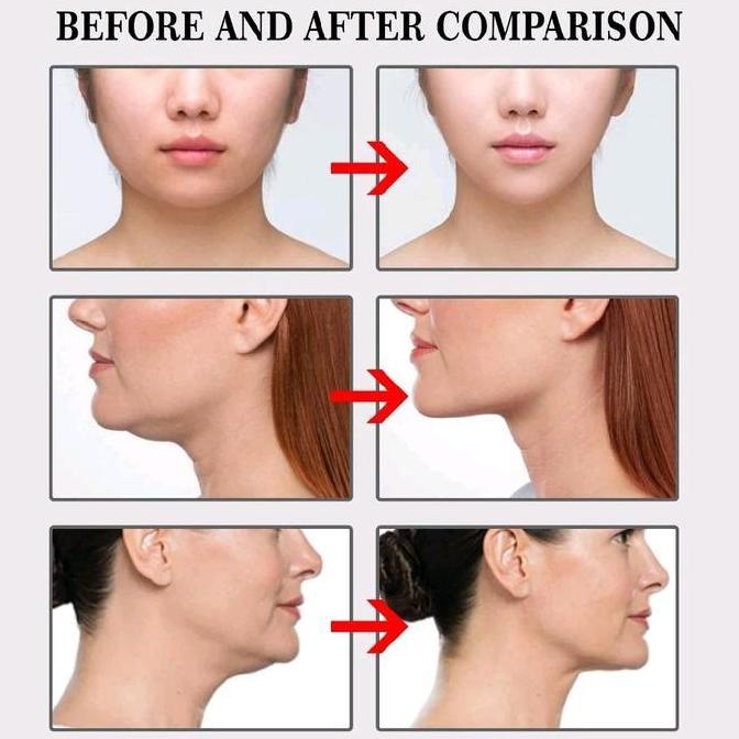 Stiker Wajah Anti Kerut V-Shaped Invisible Tape Stiker Wajah Anti Kerut / Sticker Pengencang Garis W