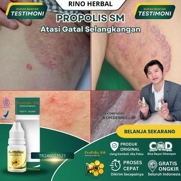 Salep Selangkangan Gatal Hitam, Selangkangan Hitam Dan Gatal, Selangkang Lecet, Jamur Selangkangan, 