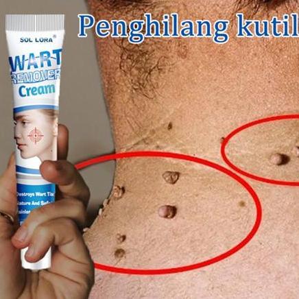 Bodies- Cod -Promo Obat Kutil Paling Ampuh Penghilang Kutil Dan Tahi Lalat Penghilang Kutil Paling A