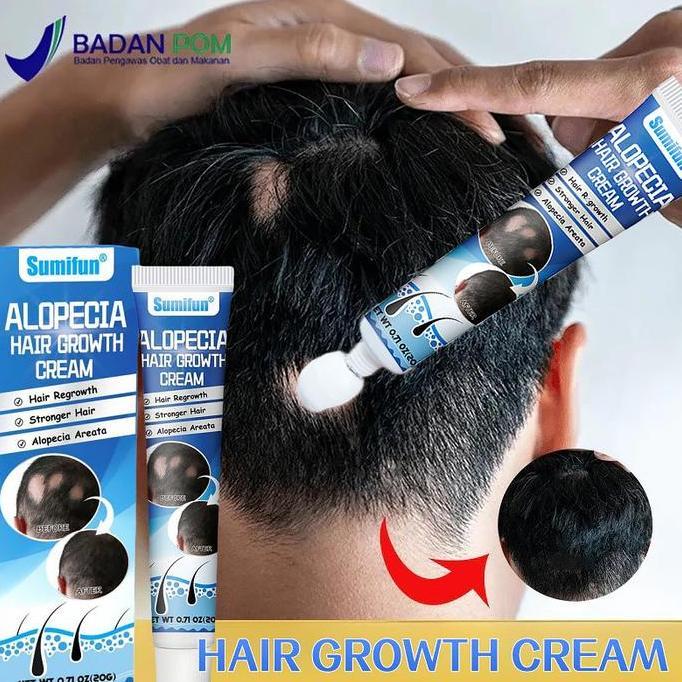 Haircare- [Ramadhan Sale] Obat Alopecia Areata, Penumbuh Rambut Cepat Obat, Penumbuh Rambut Botak Pr