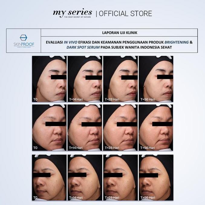 MY SERIES BEAUTYLOC SERUM 3% GHK-CU COPPER PEPTIDE NEW FORMULA [terbaik]