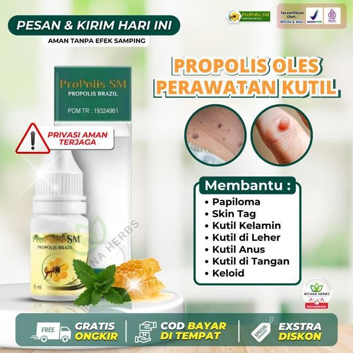 Skinn- Propolis Sm Penghilang Kutil, Menghilangkan Kutil Kelamin, Kutil Di Leher, Kutil Anus, Skin T