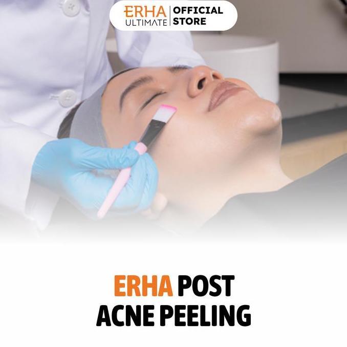 ERHA Post Acne Peeling for Face