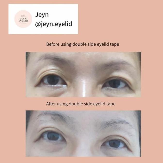 Junnismail673 - Jeyn Eyelid Lem 2 Sisi Lipatan Mata Alami