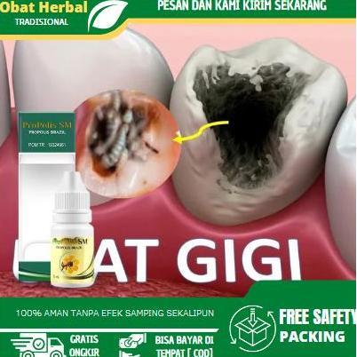 Cairan Tetes Pembersih Ulat Gigi, Pembunuh Ulat Gigi, Ulat Dalam Gigi Yang Berlubang, Cara Mengeluar