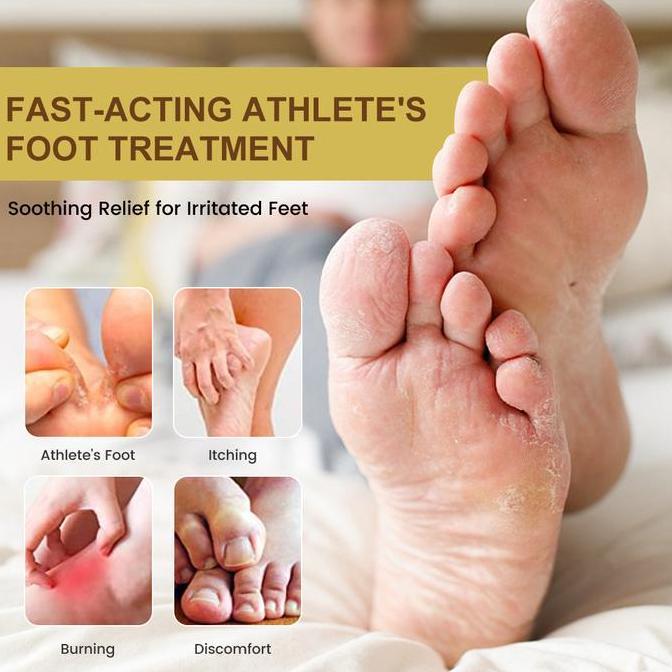 Bytwx- Salep Gatel2 Paling  Obat Telapak Kaki Rayapan 20G Salep Gatal Kulit Ampuh Obat Kaki Rayapan 