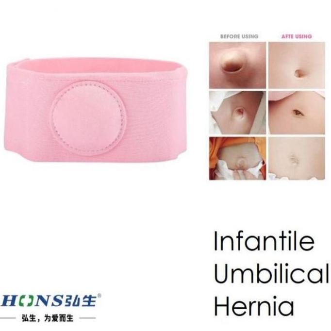 FYODORU Sabuk Hernia Bayi / Sabuk Pusar Bodong terapi anti udel bodong anak ba