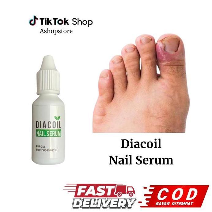 DIACOIL Nail Serum Perawatan Jamur Kuku dan Kuku Cantengan, 20ml
