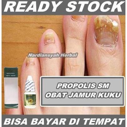 Obat Jamur Kuku, Infeksi Jamur Kuku, Salep Jamur Kuku di Tangan & Kaki