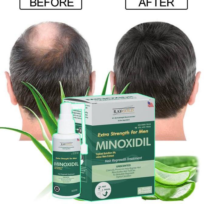MINOXIDIL 5% penumbuh rambut & brewok with Aloe Vera for MEN made in USA - RAYGOLD - MINOX MINOKSIDI