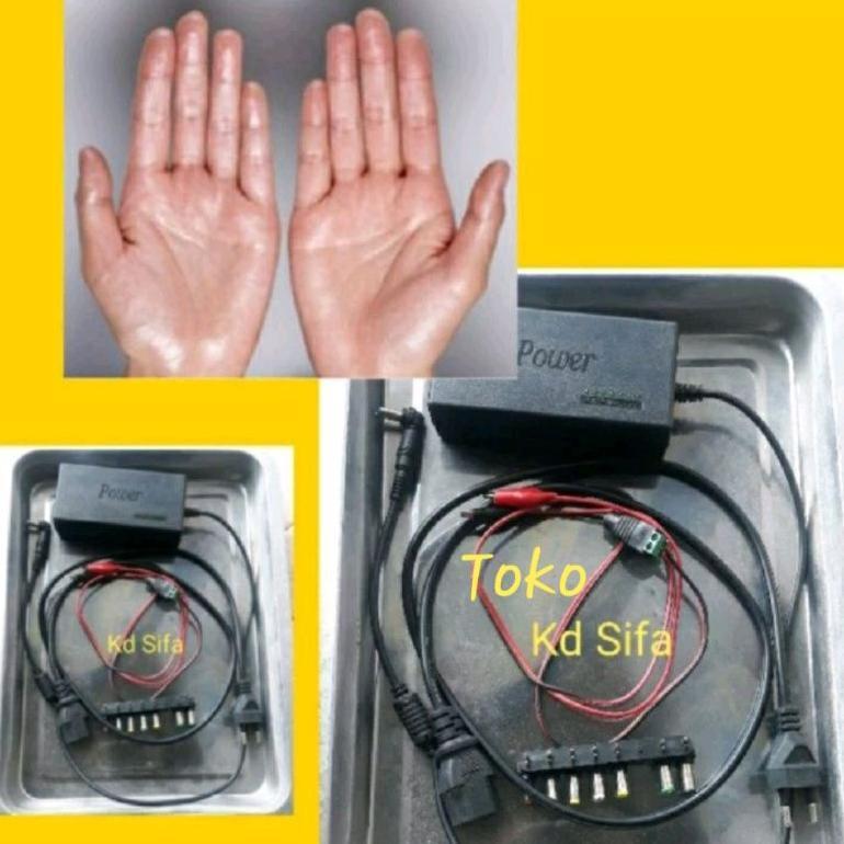 Alat Terapi Therapy Iontophoresis Keringat Kringat Berlebihan Di Telapak Tangan Dan Telapak Kaki Ata