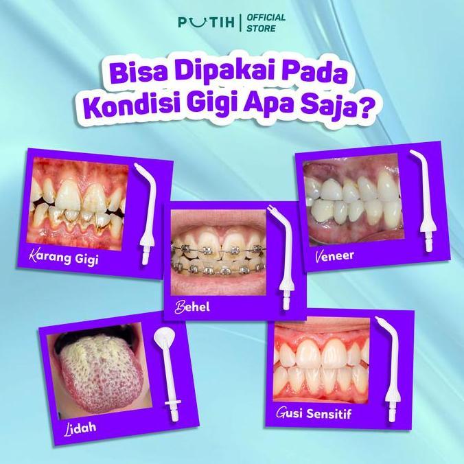 Putih Dental Water Flosser Alat Semprot Pembersih Gigi Floss Efektif Membersihkan Plak Karang Gigi S