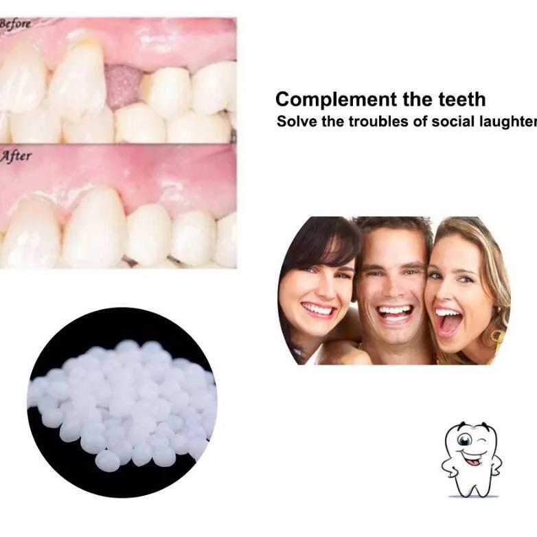Bigdeal Temptooth Diy Temporary Tooth Repair Kit Denture Adhesive Teeth Lem Gigi Palsu Tambal Sement