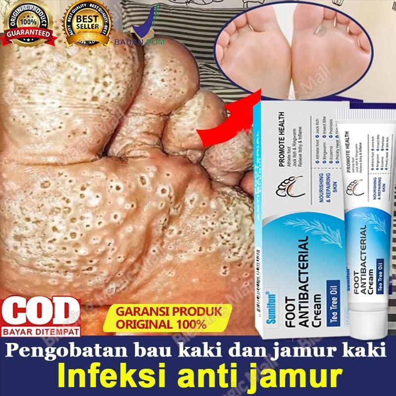 Obat Kaki Rayapan Dan Bau Obat Gatel Penghilang Bau Kaki Obat Jamur Kaki Salep Kaki Rayapan Mengobat